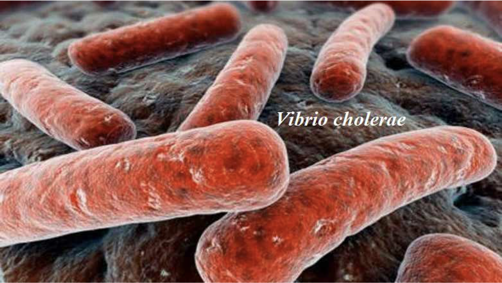pferorelli-vibrione-colera